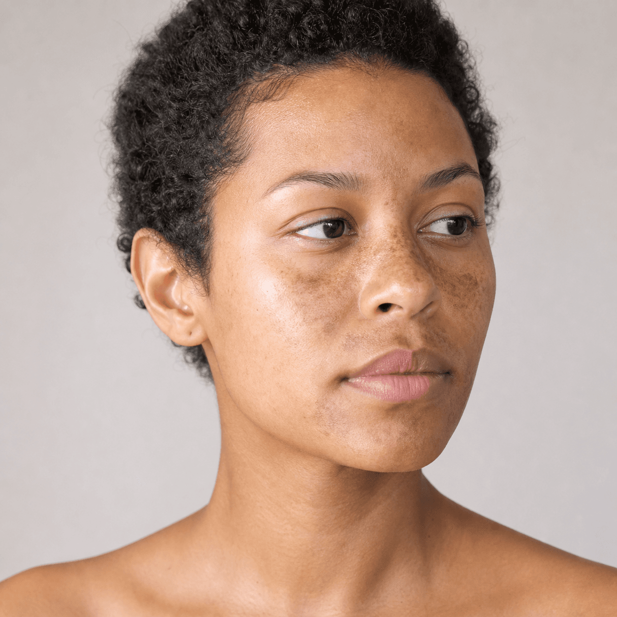Kan preventivmedel orsaka melasma? Den hormonella länken