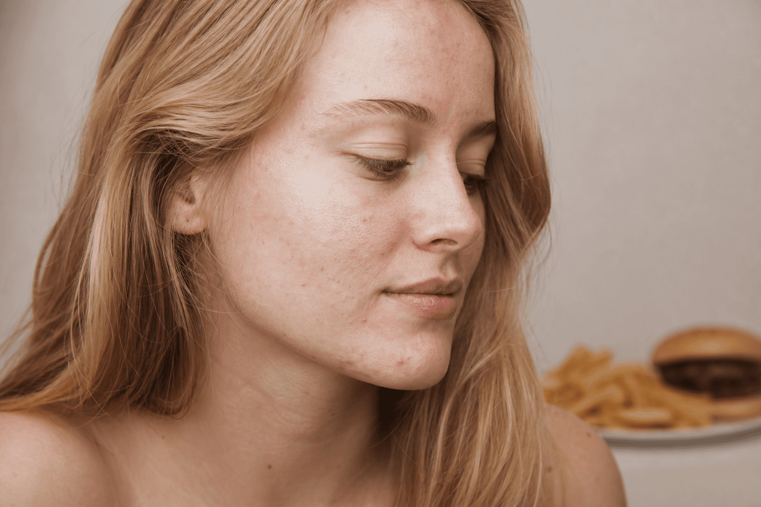 Greasy foods and acne: the myth, the nuance, and what matters - skincare guide