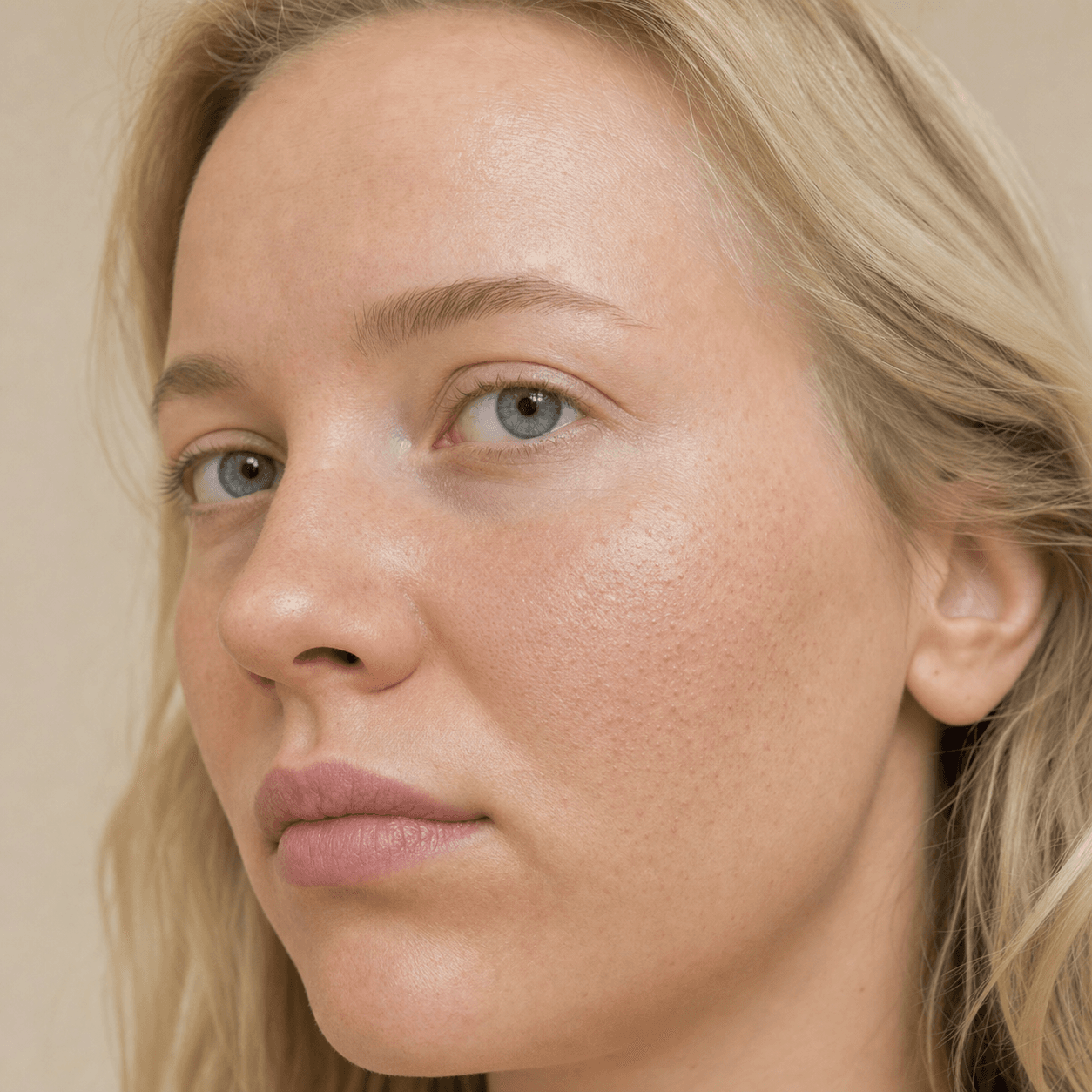 Keratosis pilaris i ansiktet: lugna knottriga kinder