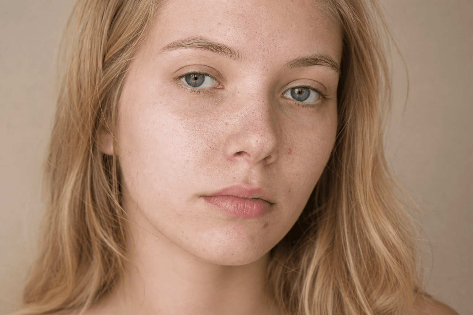 What are blackheads? The dark dots are not dirt - example skin