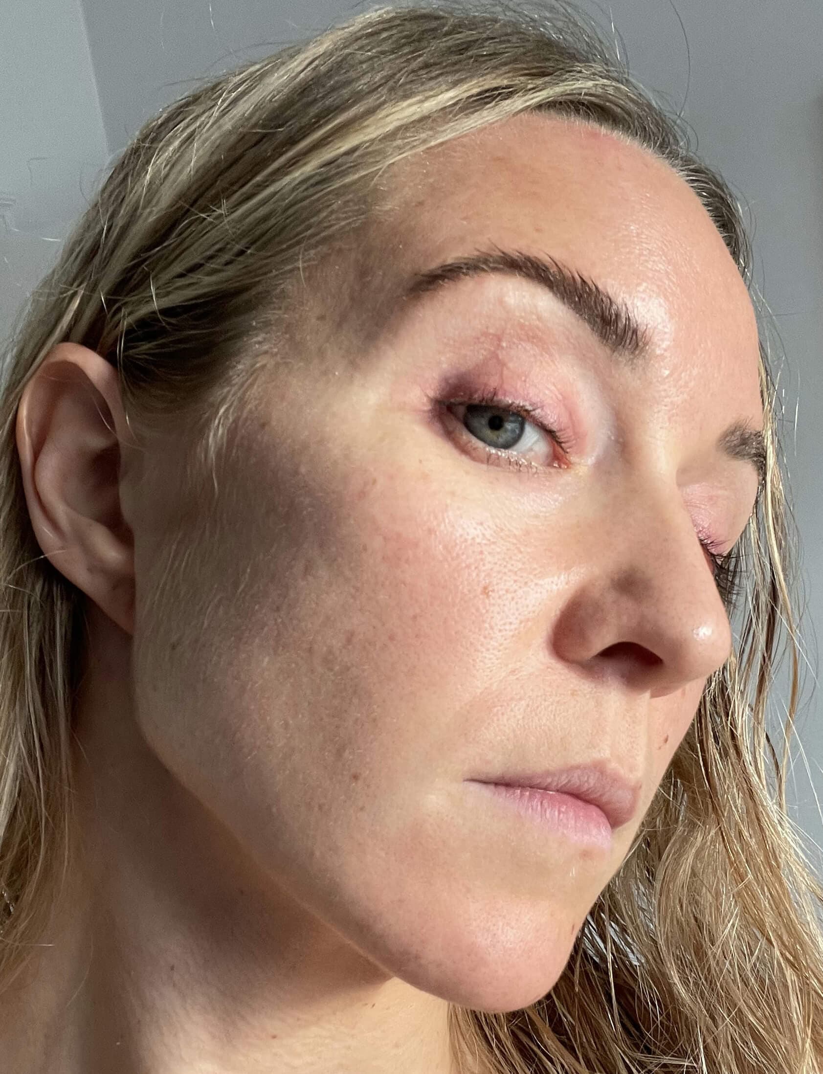 Annesofie — after