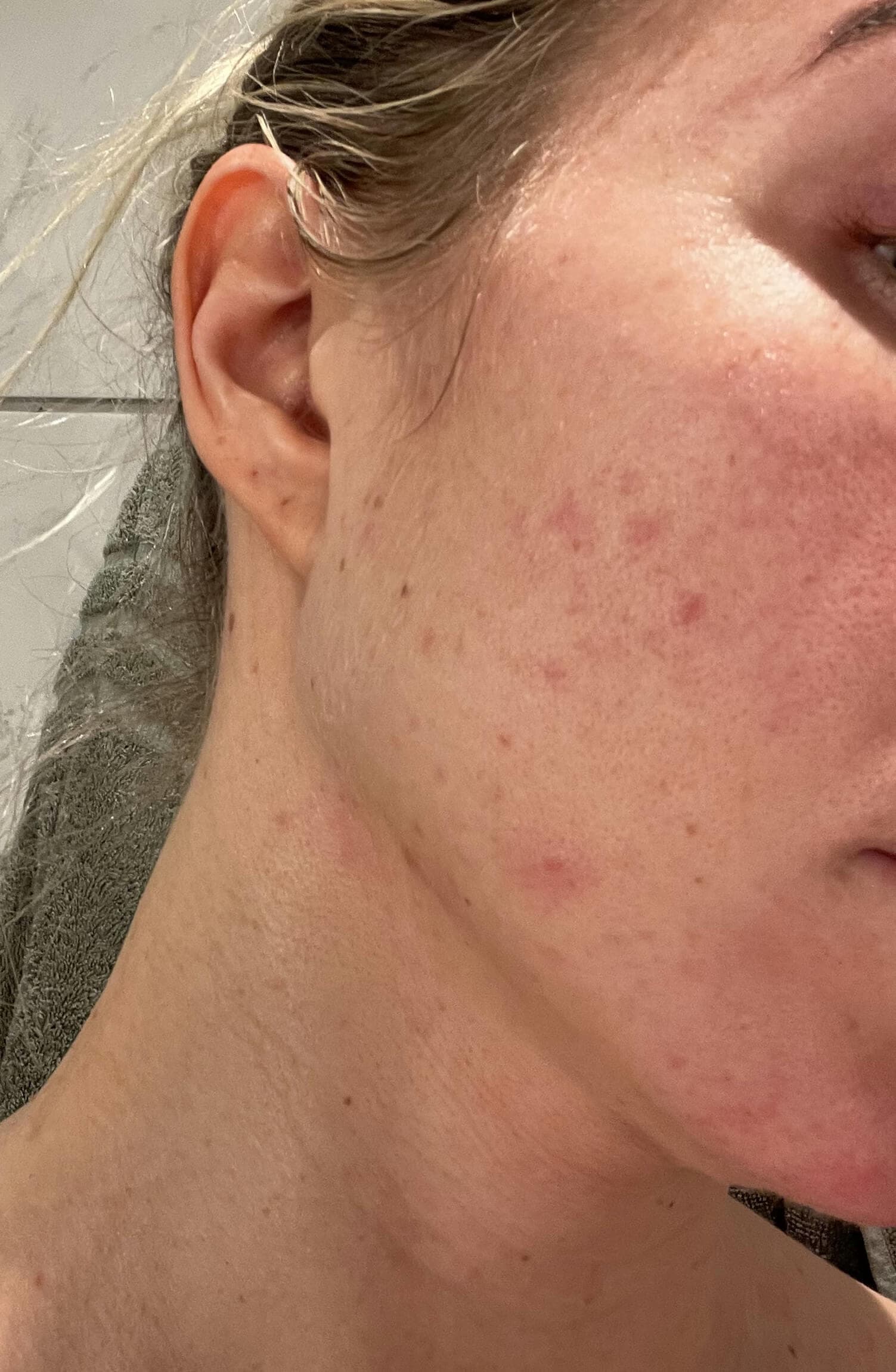 Annesofie — before