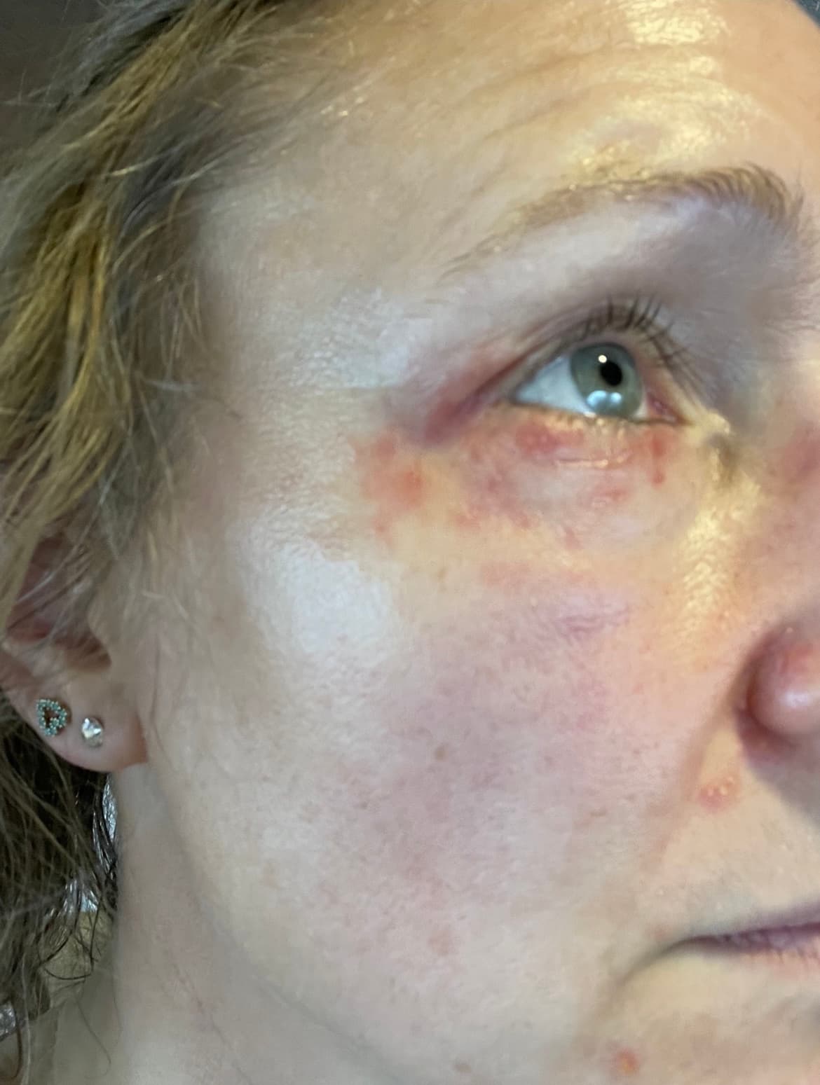 Mia Lykke Nielsen — before