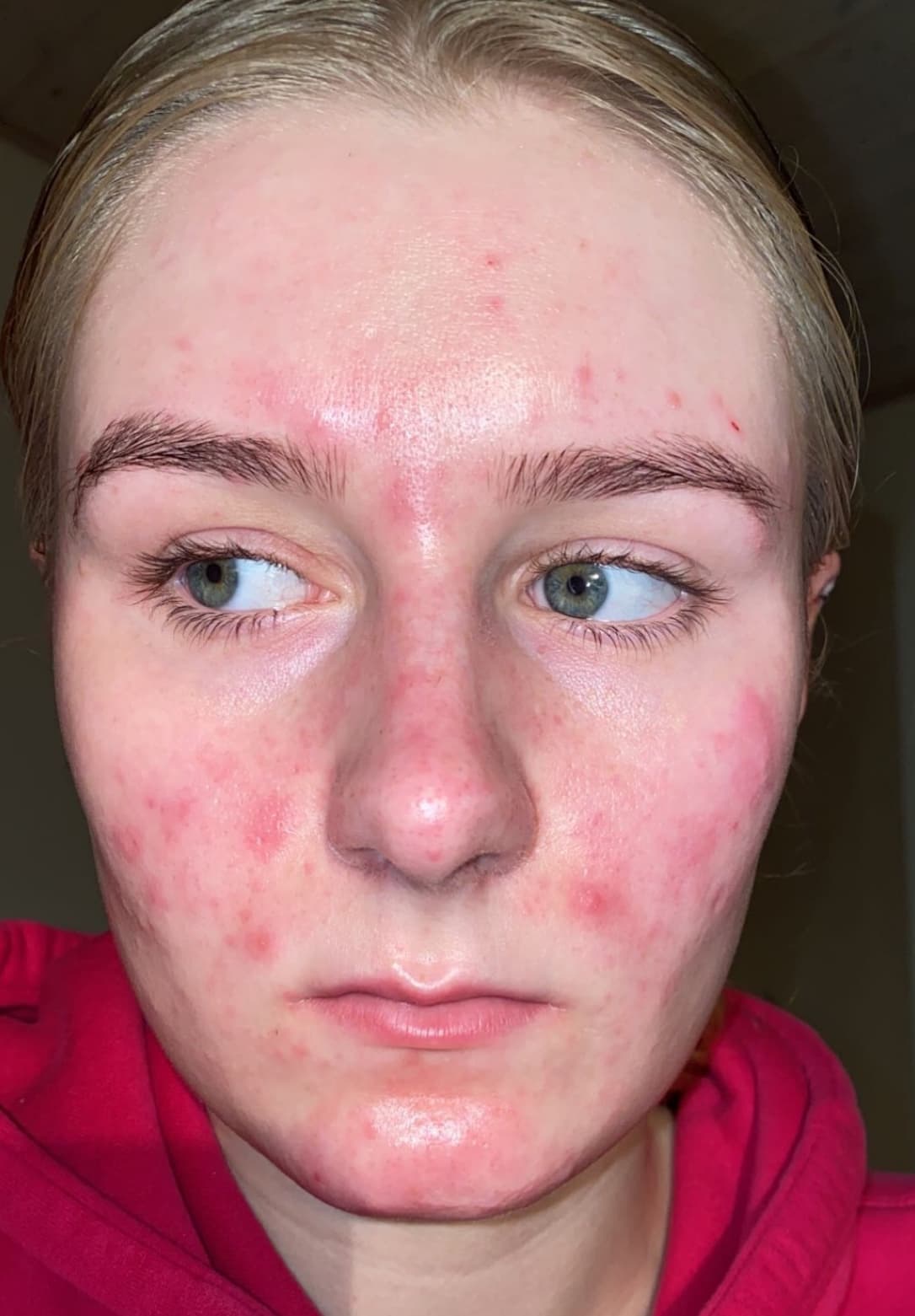 Yasmin Nielsen — before