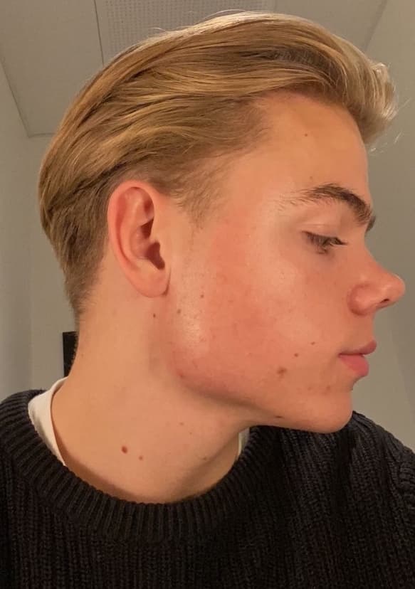 Oliver Segnitz — after