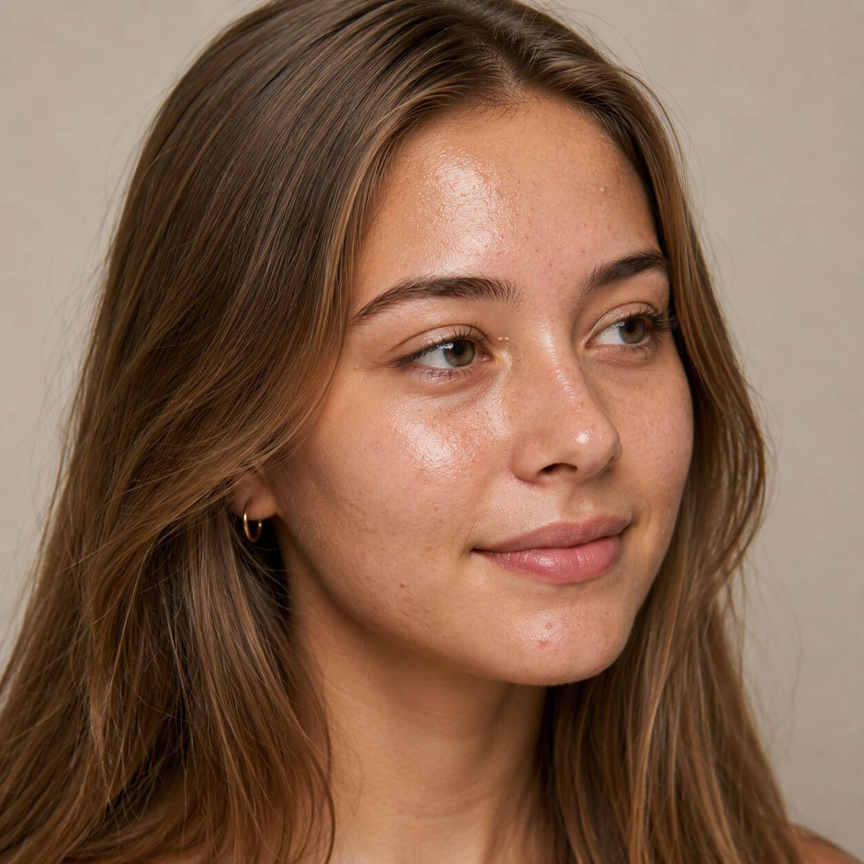 Milia — skin example