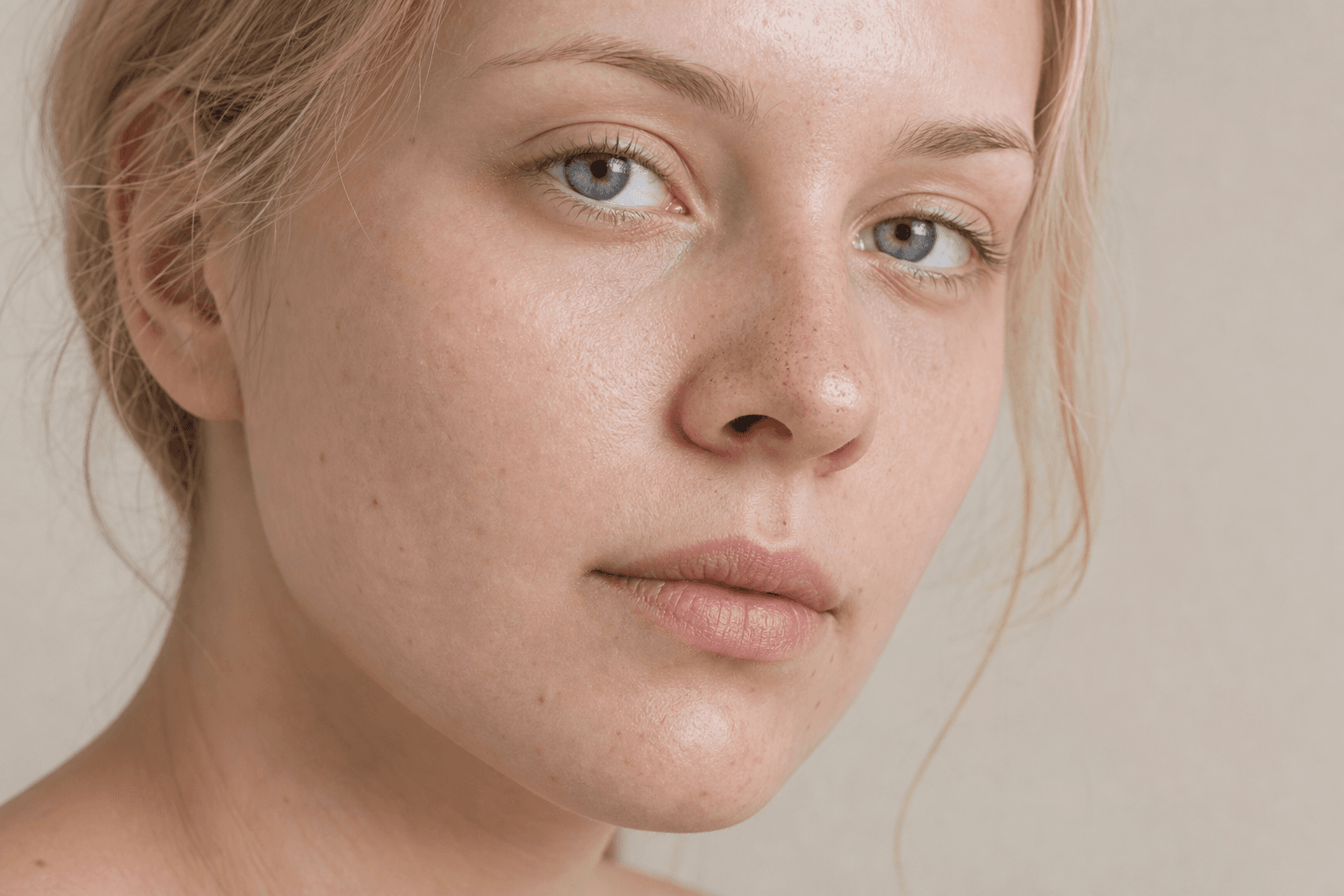 Blackheads removal: the safe decision guide - example skin