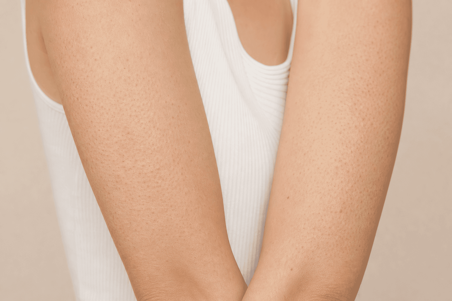 Keratosis pilaris on arms: how to smooth bumpy upper arms - example skin