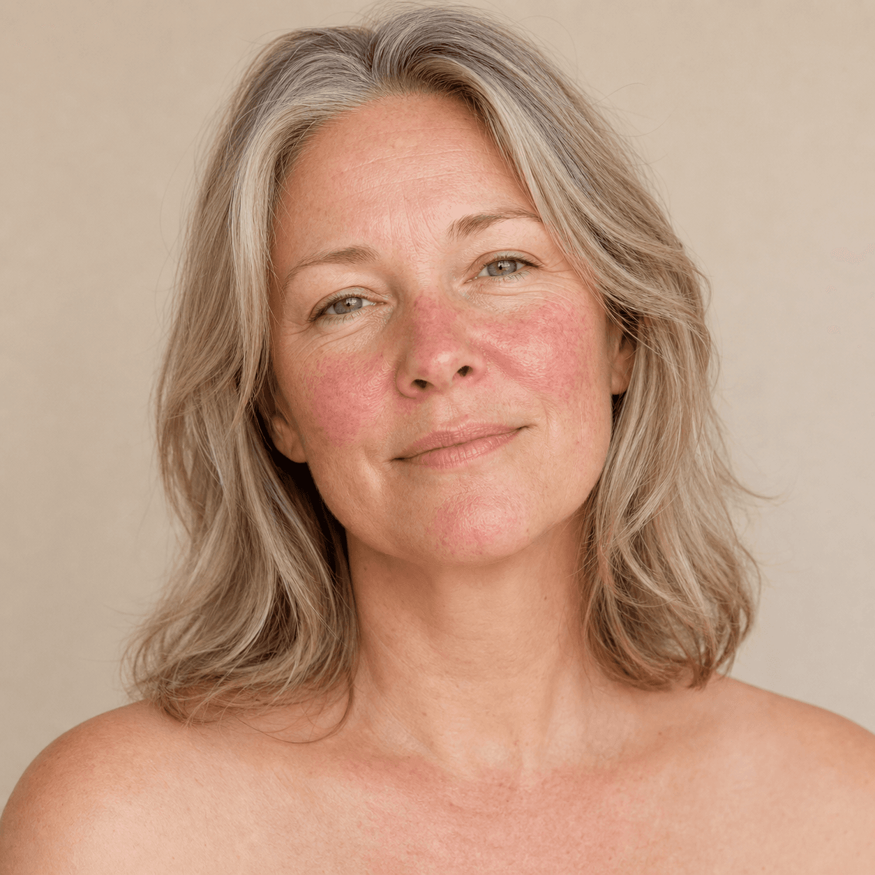 Rosacea and menopause: hot flashes, flushing and skin care