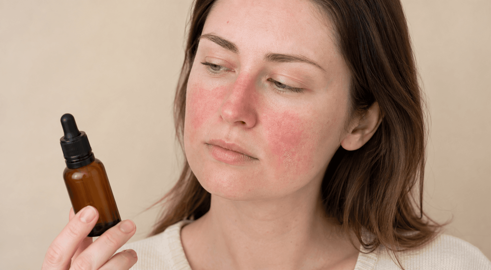 Rosacea e retinolo: quando fermarti, ripartire o rinunciare