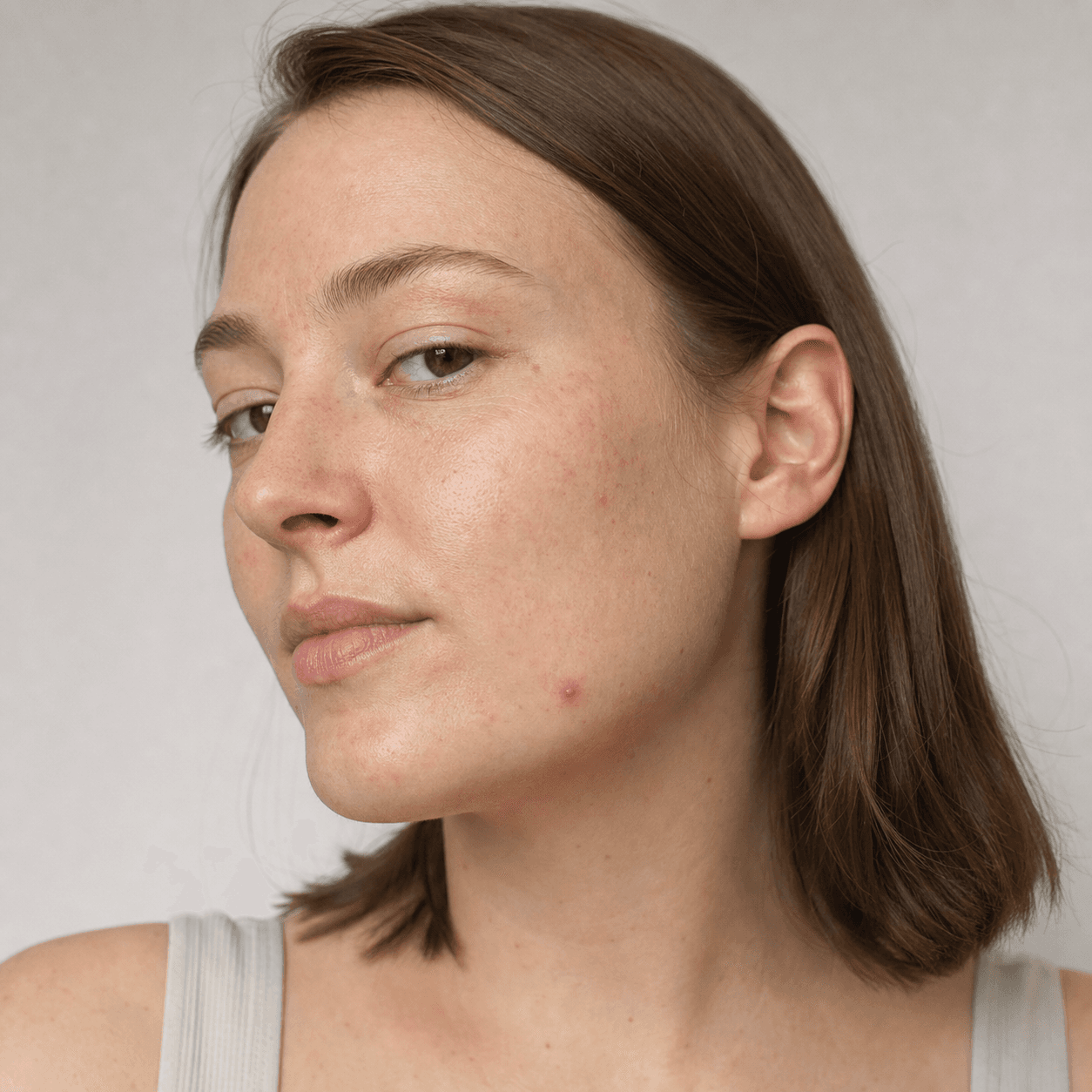 Why does the same pimple keep coming back?