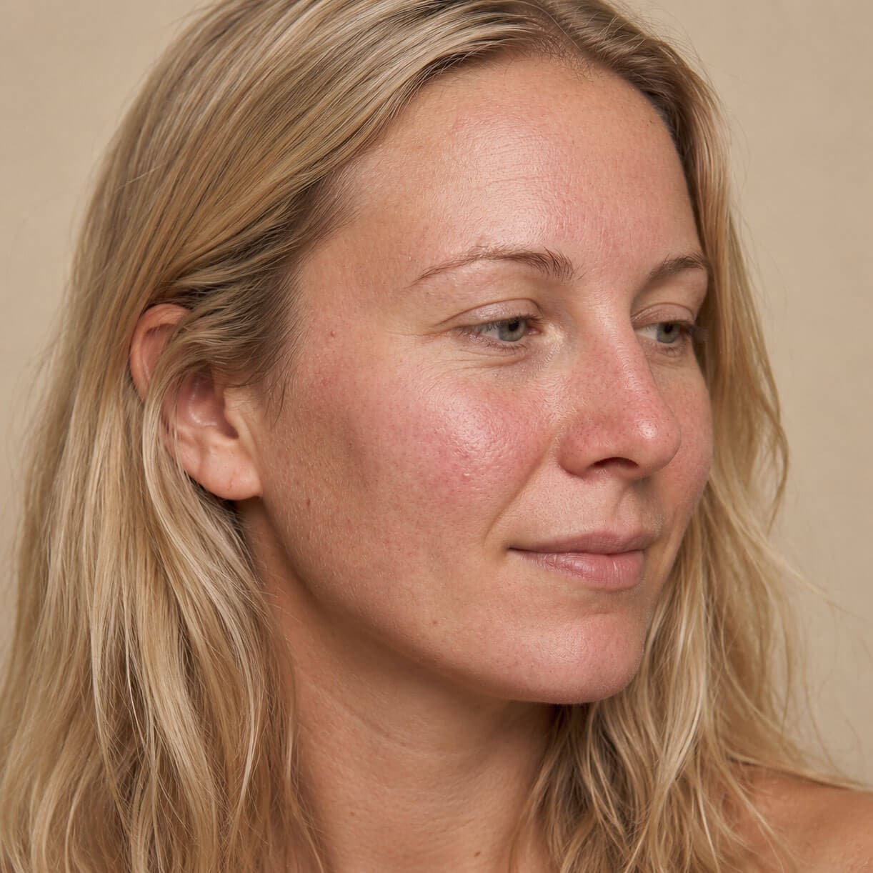 Sensitive skin — skin example